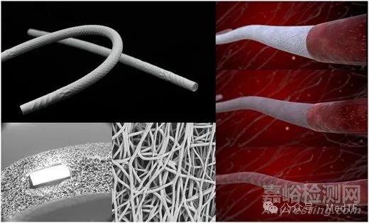 【创新医械】XABG：用于冠状动脉搭桥手术的修复性人造血管