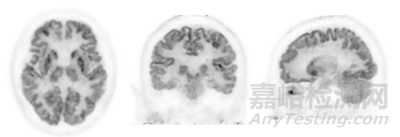 【创新医械】岛津研发的头部和乳房高分辨率正电子发射断层扫描PET系统获批FDA