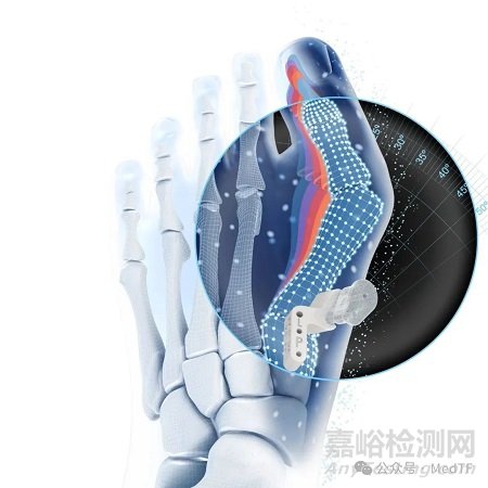 强生推出首款骨科AI产品