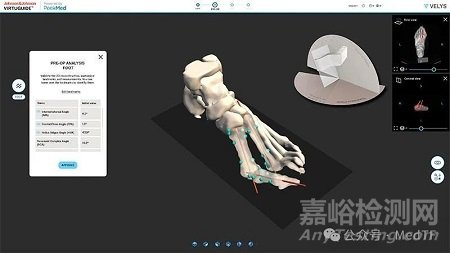 强生推出首款骨科AI产品