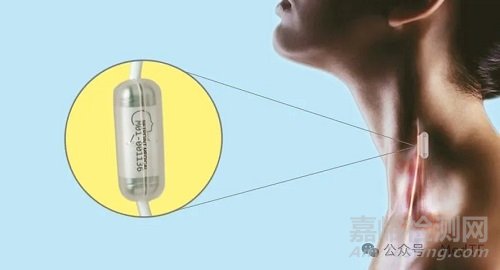 【创新医械】SetPoint：首款神经免疫刺激器获FDA批准，治疗类风湿关节炎