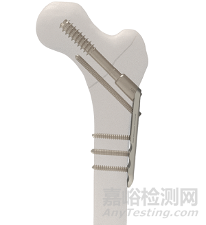 【创新医械】模块化设计的3P小儿髋部植入系统技术解析
