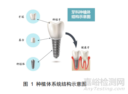 《牙科种植体系统生产环节风险清单和检查指南》