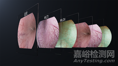 全球首创，智能对焦自动放大激光多光谱内窥镜获批上市