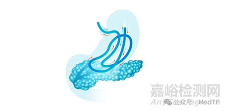 Arctx Cool Catheter：急性胰腺炎无创冷冻疗法