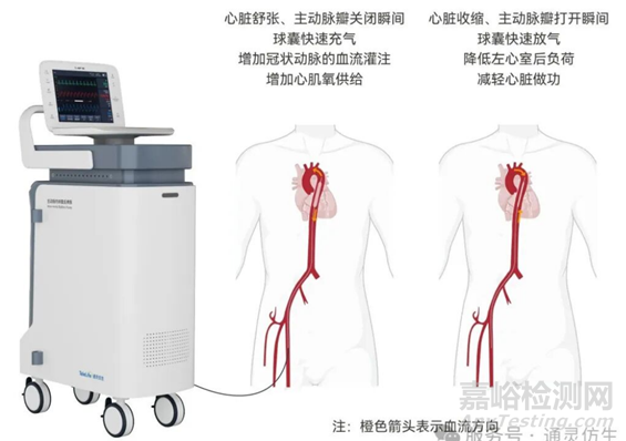 国产首款主动脉内球囊反搏导管套件获批上市