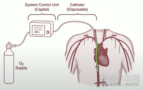 【创新医械】VQ Catheter：血管内氧合导管，血管内气体交换的ECMO