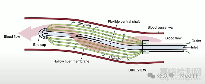 【创新医械】VQ Catheter：血管内氧合导管，血管内气体交换的ECMO
