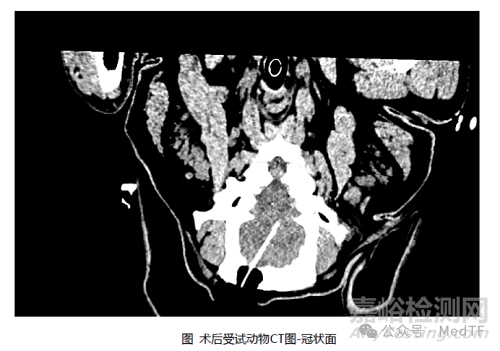 国产首家全自研脑外科电磁导航系统