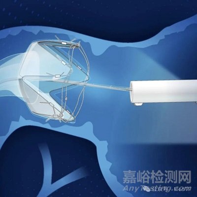 【创新医械】RESET胃转流支架，平均减重近18.9%，1298名真实世界研究