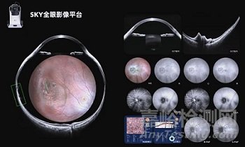 国产首款全眼影像平台获批CE