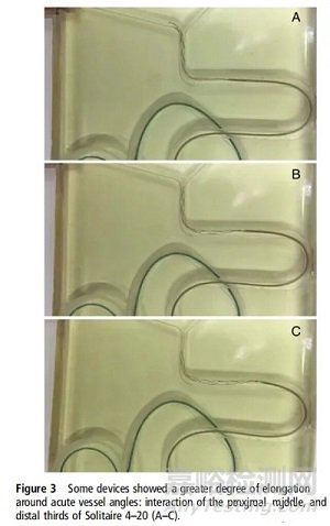 支架取栓器的设计与制造